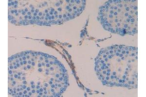 Used in DAB staining on fromalin fixed paraffin- embedded spleen tissue