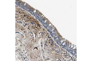 Immunohistochemical staining of human bronchus with TMEM186 polyclonal antibody  shows moderate cytoplasmic and membranous positivity in respiratory epithelial cells at 1:50-1:200 dilution. (TMEM186 anticorps)