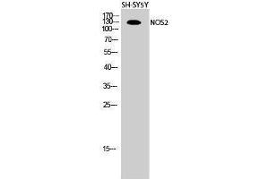 Western Blotting (WB) image for anti-Nitric Oxide Synthase 2, Inducible (NOS2) (Thr177) antibody (ABIN3176385) (NOS2 anticorps  (Thr177))