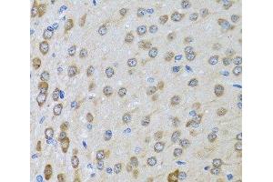 Immunohistochemistry of paraffin-embedded Rat brain using BTD Polyclonal Antibody at dilution of 1:100 (40x lens).
