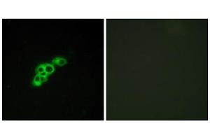 Immunofluorescence analysis of MCF-7 cells, using FSHR antibody. (FSHR anticorps  (Internal Region))