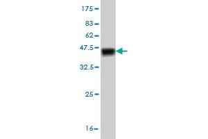 Western Blot detection against Immunogen (40. (TESK2 anticorps  (AA 405-542))