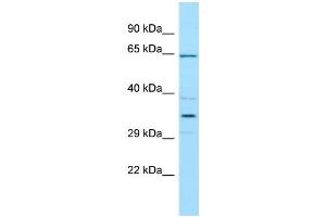 WB Suggested Anti-CFHR5 Antibody Titration: 1. (CFHR5 anticorps  (N-Term))