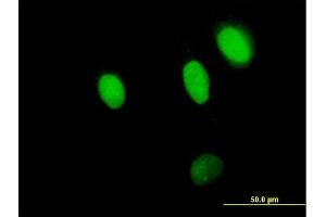 Immunofluorescence of purified MaxPab antibody to NPLOC4 on HeLa cell. (NPLOC4 anticorps  (AA 1-608))