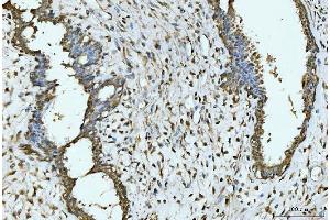 IHC analysis of EXOSC8 using anti-EXOSC8 antibody (ABIN7601850). (EXOSC8 anticorps  (AA 49-216))