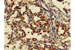 Immunohistochemistry of paraffin-embedded human lung tissue using ABIN7149454 at dilution of 1:100