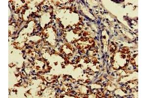 Immunohistochemistry of paraffin-embedded human lung tissue using ABIN7149454 at dilution of 1:100 (DDO anticorps  (AA 37-161))