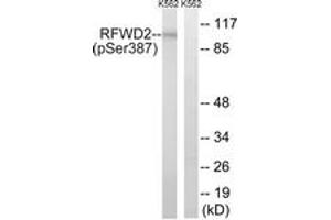 Western blot analysis of extracts from K562 cells treated with UV 15', using RFWD2 (Phospho-Ser387) Antibody. (RFWD2 anticorps  (pSer387))