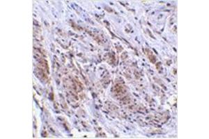 Immunohistochemistry of TRIM5 gamma in human bladder tissue with TRIM5 gamma antibody at 2 μg/ml.
