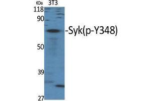 Western Blot (WB) analysis of specific cells using Phospho-Syk (Y348) Polyclonal Antibody.