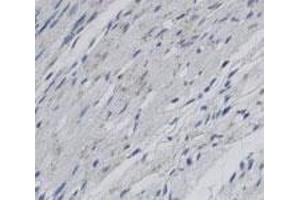 Staining of Scarb2 in rat infarctzone tissue using Scarb2 polyclonal antibody  with a DAB detection system. (SCARB2 anticorps)