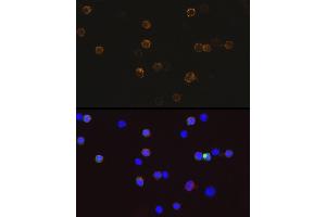 Immunofluorescence analysis of 293T-BC-Flag-GFP-C cells using Mouse anti DDDDK-Tag mAb (ABIN3020558, ABIN3020559, ABIN3020560 and ABIN1512923) at dilution of 1:100 (40x lens). (DYKDDDDK Tag anticorps)