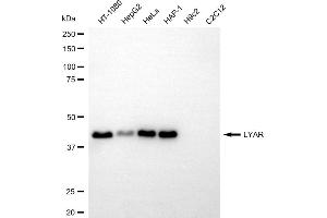 anti-Ly1 Antibody Reactive (LYAR) antibody