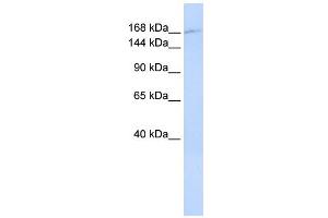 WB Suggested Anti-ZNF646 Antibody Titration:  0. (ZNF646 anticorps  (N-Term))
