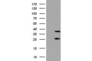 Western Blotting (WB) image for anti-Proteasome (Prosome, Macropain) Subunit, beta Type, 7 (PSMB7) (AA 58-277) antibody (ABIN1491598) (PSMB7 anticorps  (AA 58-277))