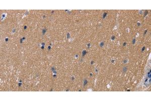 Immunohistochemistry of paraffin-embedded Human brain tissue using KCNJ11 Polyclonal Antibody at dilution 1:40 (KCNJ11 anticorps)