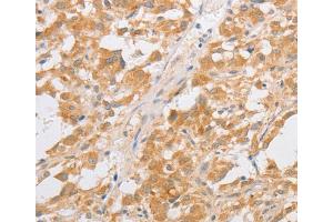 Immunohistochemistry (IHC) image for anti-CDKN2A Interacting Protein (CDKN2AIP) antibody (ABIN2421960) (CDKN2AIP anticorps)