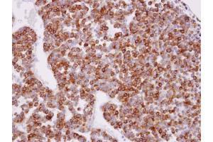 IHC-P Image Immunohistochemical analysis of paraffin-embedded human pituitary gland tumor, using XPR1, antibody at 1:100 dilution. (xpr1 anticorps  (N-Term))