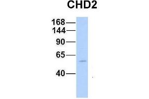 Host:  Rabbit  Target Name:  CHD2  Sample Type:  Human Fetal Muscle  Antibody Dilution:  1. (CHD2 anticorps  (N-Term))