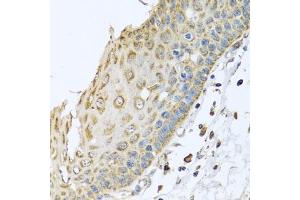 Immunohistochemistry of paraffin-embedded human esophagus using ARFGAP3 antibody (ABIN5974520) at dilution of 1/100 (40x lens). (ARFGAP3 anticorps)