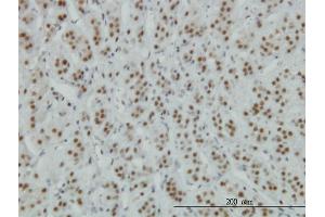 Immunoperoxidase of monoclonal antibody to ZNF207 on formalin-fixed paraffin-embedded human adrenal gland.