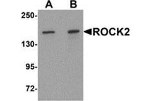 Western blot analysis of ROCK2 in mouse brain tissue lysate with ROCK2 antibody at (A) 1 and (B) 2 μg/ml (ROCK2 anticorps  (Center))