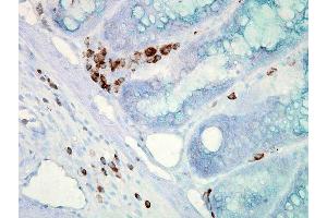 Immunohistochemistry analysis using Mouse Anti-Hsp70 Monoclonal Antibody, Clone C92 .