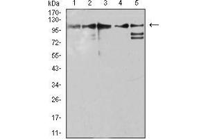 Western blot analysis using ZFP91 mouse mAb against Jurkat (1), A431 (2), HepG2 (3), HEK293 (4), and A549 (5) cell lysate. (ZFP91 anticorps  (AA 162-304))