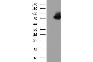 Western Blotting (WB) image for anti-Oxysterol Binding Protein-Like 11 (OSBPL11) antibody (ABIN1499919) (OSBPL11 anticorps)