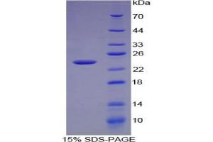 SDS-PAGE analysis of Mouse CXCL15 Protein.