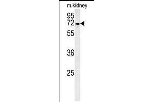 Western blot analysis in mouse kidney tissue lysates (35ug/lane). (GNE anticorps  (C-Term))