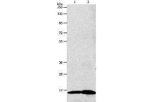 Western Blot analysis of 293T cell and Human fetal brain tissue using LHB Polyclonal Antibody at dilution of 1:800 (LHB anticorps)