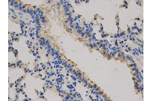 Immunohistochemistry (IHC) image for anti-Carcinoembryonic Antigen-Related Cell Adhesion Molecule 3 (CEACAM3) antibody (ABIN1871781) (CEACAM3 anticorps)