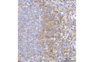 IHC analysis of Hamartin/TSC1 using anti-Hamartin/TSC1 antibody (ABIN7599499). (TSC1 anticorps  (AA 1-618))