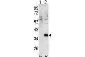Western Blotting (WB) image for anti-Docking Protein 4 (DOK4) antibody (ABIN3003434) (DOK4 anticorps)