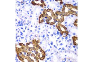 Immunohistochemistry of paraffin-embedded rat kidney using KRT19 antibody. (Cytokeratin 19 anticorps)