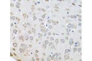 Immunohistochemistry of paraffin-embedded Mouse brain using Polyclonal AntibodyPC4 Polyclonal Antibody at dilution of 1:100 (40x lens). (SUB1 anticorps)