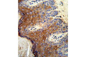 Immunohistochemistry (IHC) image for anti-Arachidonate 12-Lipoxygenase (ALOX12) antibody (ABIN3003946)