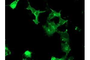 Image no. 2 for anti-PTK7 Protein tyrosine Kinase 7 (PTK7) antibody (ABIN1497127)