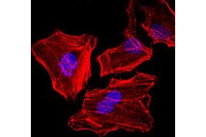 Immunofluorescence analysis of HeLa cells. (Cytokeratin 5 anticorps)