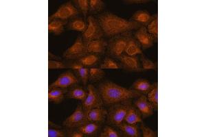 Immunofluorescence analysis of U-2 OS cells using [KO] GIT1 antibody (ABIN7267383) at dilution of 1:100. (GIT1 anticorps  (AA 460-640))