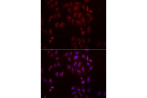 Immunofluorescence analysis of A549 cells using FRZB antibody (ABIN5973961). (FRZB anticorps)