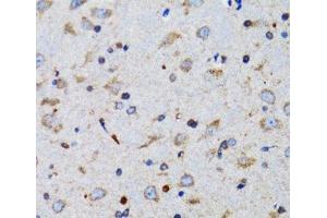 Immunohistochemistry of paraffin-embedded Mouse brain using TNFSF12 Polyclonal Antibody at dilution of 1:100 (40x lens). (TWEAK anticorps)