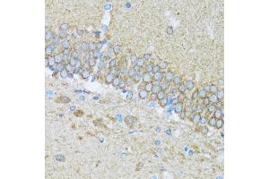 Immunohistochemistry of paraffin-embedded mouse brain using CASP3 antibody. (Caspase 3 anticorps)