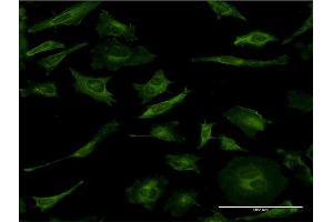 Immunofluorescence of monoclonal antibody to MAPK8 on HeLa cell.
