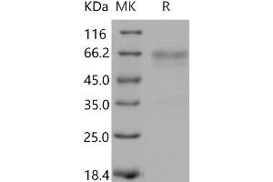 Western Blotting (WB) image for Tumor Necrosis Factor Receptor Superfamily, Member 14 (TNFRSF14) (Active) protein (His tag,Fc Tag) (ABIN7198448)