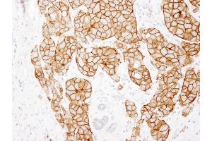 Immunohistochemistry (IHC) image for anti-Receptor tyrosine-protein kinase erbB-2 (ErbB2/Her2) (C-Term) antibody (ABIN7448962) (ErbB2/Her2 anticorps  (C-Term))