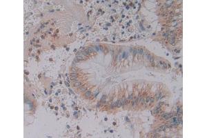 anti-Glutamine-Fructose-6-Phosphate Transaminase 2 (GFPT2) (AA 2-288) antibody