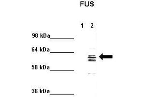 WB Suggested Anti-FUS Antibody    Positive Control:  Lane 1: 5ug mouse brain cytoplasm Lane 2: 5ug mouse brain nucleus   Primary Antibody Dilution :   1:1000  Secondary Antibody :  Anti rabbit - IR-dye  Secondry Antibody Dilution :   1:10,000   Submitted by:  Anonymous