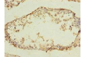Immunohistochemistry of paraffin-embedded human testis tissue using  at dilution of 1:100 (CLEC4C anticorps  (AA 45-213))